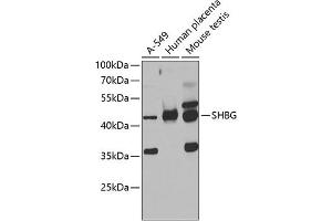 Western blot analysis of extracts of various cell lines, using SHBG antibody (ABIN6129327, ABIN6147736, ABIN6147737 and ABIN6223329) at 1:1000 dilution. (SHBG antibody  (AA 30-170))