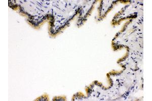 Anti- RAGE Picoband antibody, IHC(P) IHC(P): Rat Lung Tissue (RAGE antibody  (N-Term))