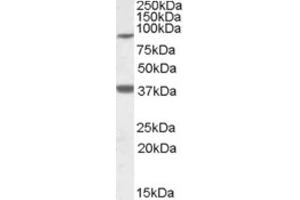 Western Blotting (WB) image for anti-Ceramide Synthase 1 (CERS1) (Internal Region) antibody (ABIN2466789) (LASS1 antibody  (Internal Region))