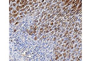 anti-Trefoil Factor 1 (TFF1) (AA 22-87) antibody