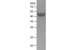 Western Blotting (WB) image for Cyclin-Dependent Kinase Inhibitor 1C (p57, Kip2) (CDKN1C) (AA 34-316) protein (His tag) (ABIN7283421) (CDKN1C Protein (AA 34-316) (His tag))