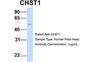 Host: Rabbit Target Name: CHST1 Sample Type: Human Fetal Heart Antibody Dilution: 1. (CHST1 antibody  (Middle Region))