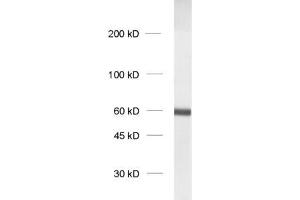 dilution: 1 : 1000, sample: crude synaptosomal fraction of rat brain (P2) (SYT1 antibody  (Lumenal Region))