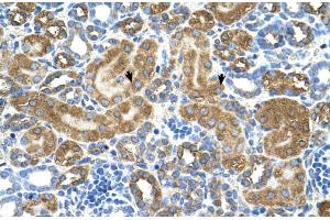 Human kidney (ATIC antibody  (Middle Region))