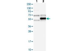 Western blot analysis of Lane 1: Negative control (vector only transfected HEK293T lysate), Lane 2: Over-expression Lysate (Co-expressed with a C-terminal myc-DDK tag (~3. (TRMT5 antibody)