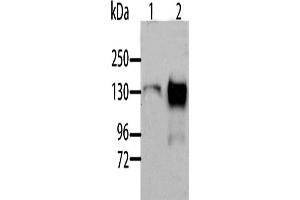 Western Blotting (WB) image for anti-Aldehyde Oxidase 1 (AOX1) antibody (ABIN2429101) (AOX1 antibody)