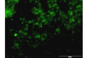Immunofluorescence (IF) image for anti-Tyrosinase (TYR) (AA 1-377) antibody (ABIN563307)