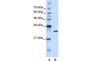 Western Blotting (WB) image for anti-Goosecoid Homeobox 2 (GSC2) antibody (ABIN2461751) (GSC2 antibody)