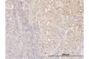 Image no. 3 for anti-Cofilin 1 (CFL1) (AA 1-167) antibody (ABIN598606) (Cofilin antibody  (AA 1-167))