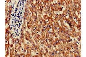Immunohistochemistry of paraffin-embedded human liver tissue using ABIN7154260 at dilution of 1:100 (GRHPR antibody  (AA 1-328))