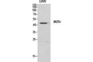 Western Blot (WB) analysis of specific cells using MCT4 Polyclonal Antibody. (SLC16A3 antibody  (Internal Region))