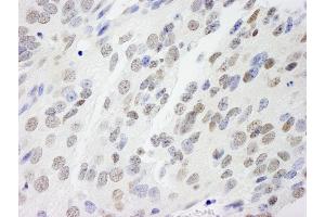 Immunohistochemistry (IHC) image for anti-Non-POU Domain Containing, Octamer-Binding (NONO) (AA 350-400) antibody (ABIN7448694) (NONO antibody  (AA 350-400))