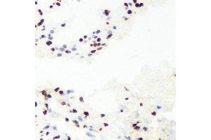 Immunohistochemical analysis of RNGTT staining in mouse lung formalin fixed paraffin embedded tissue section.