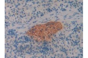 Detection of CBG in Rat Spleen Tissue using Polyclonal Antibody to Corticosteroid Binding Globulin (CBG) (SERPINA6 antibody  (AA 267-390))