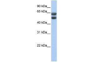 WB Suggested Anti-ZNF331 Antibody Titration:  0.