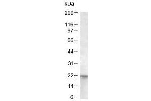 Western blot of A431 lysate with NRAS antibody at 0. (GTPase NRas antibody)