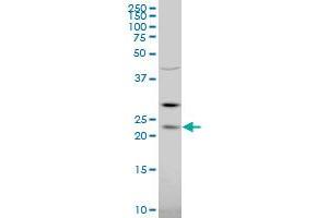 RGS5 polyclonal antibody (A01), Lot # 060608JCS1 Western Blot analysis of RGS5 expression in K-562 . (RGS5 antibody  (AA 94-181))