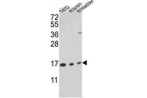 Western blot analysis of PPIA Antibody (PPIA antibody  (N-Term))