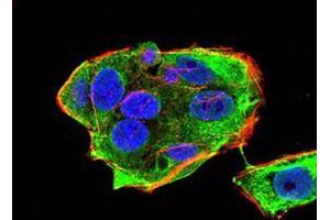 Immunofluorescence (IF) image for anti-DEAD (Asp-Glu-Ala-Asp) Box Polypeptide 20 (DDX20) (AA 725-824) antibody (ABIN5542507)