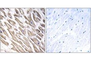 Immunohistochemistry analysis of paraffin-embedded human heart tissue, using F13B Antibody. (F13B antibody  (AA 61-110))