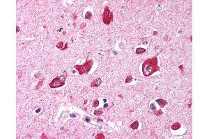 Anti-TRIM35 antibody IHC of human brain, cortex. (TRIM35 antibody  (AA 145-194))