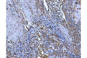 IHC analysis of Hsp47/SERPINH1 using anti-Hsp47/SERPINH1 antibody (ABIN3043331). (SERPINH1 antibody  (AA 247-418))