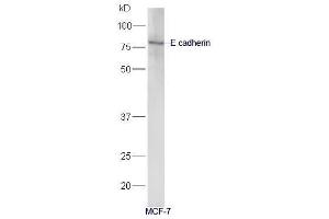 Human MCF-7 lysates probed with Anti-E cadherin Polyclonal Antibody, Unconjugated  at 1:5000 90min in 37˚C (E-cadherin antibody  (AA 401-500))