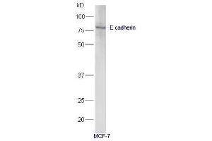 Western Blotting (WB) image for anti-Cadherin 1, Type 1, E-Cadherin (Epithelial) (CDH1) (AA 401-500) antibody (ABIN1387847)