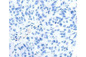 Immunohistochemistry (IHC) image for anti-Glutamate Receptor, Metabotropic 8 (GRM8) antibody (ABIN1872903) (GRM8 antibody)