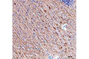 IHC analysis of Alpha Internexin using anti-Alpha Internexin antibody (ABIN4886634). (INA antibody  (AA 71-161))
