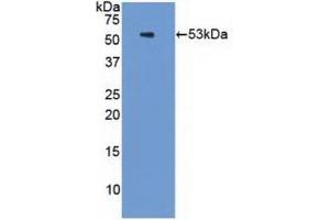 Detection of Recombinant PSMC3, Human using Polyclonal Antibody to Proteasome 26S Subunit, ATPase 3 (PSMC3) (PSMC3 antibody  (AA 2-439))