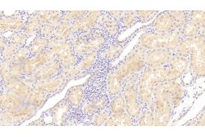 Detection of IL23a in Human Kidney Tissue using Polyclonal Antibody to Interleukin 23 Subunit Alpha (IL23a) (IL23A antibody  (AA 20-189))