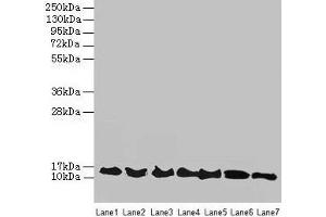 Western blot All lanes: ATP6V1G2 antibody at 12 μg/mL Lane 1: Rat heart tissue Lane 2: Mouse spleen tissue Lane 3: Hela whole cell lysate Lane 4: HepG2 whole cell lysate Lane 5: A549 whole cell lysate Lane 6: HT29 whole cell lysate Lane 7: K562 whole cell lysate Secondary Goat polyclonal to rabbit IgG at 1/10000 dilution Predicted band size: 14, 9 kDa Observed band size: 14 kDa (ATP6V1G2 antibody  (AA 1-118))