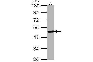 WB Image Sample (30 ug of whole cell lysate) A: Hep G2 , 10% SDS PAGE HNF-3-beta antibody antibody diluted at 1:1000 (FOXA2 antibody  (C-Term))