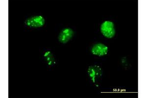 Immunofluorescence of purified MaxPab antibody to TCF19 on HeLa cell. (TCF19 antibody  (AA 1-345))