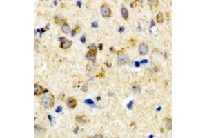 Immunohistochemical analysis of CALHM1 staining in rat brain formalin fixed paraffin embedded tissue section. (CALHM1 antibody)
