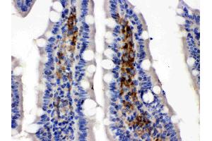 SLC2A5 was detected in paraffin-embedded sections of rat intestine cancer tissues using rabbit anti-SLC2A5 Antigen Affinity purified polyclonal antibody (Catalog # ) at 1 µg/mL. (SLC2A5 antibody  (Middle Region))