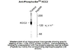 Western blot of Anti-Potassium Chloride Cotransporter (KCC2) pS940 (Rabbit) Antibody - 612-401-E15 Western Blot of Rabbit anti-Potassium Chloride Cotransporter (KCC2) pS940 antibody. (KCC2 antibody  (pSer940))