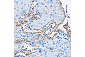 Immunohistochemistry of paraffin-embedded Mouse kidney using C Rabbit pAb (ABIN3022800, ABIN3022801, ABIN3022802 and ABIN6219234) at dilution of 1:50 (40x lens). (CAPZA2 antibody  (AA 1-286))