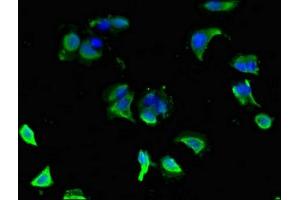 Immunofluorescent analysis of MCF-7 cells using ABIN7154186 at dilution of 1:100 and Alexa Fluor 488-congugated AffiniPure Goat Anti-Rabbit IgG(H+L) (GLRA1 antibody  (AA 23-113))
