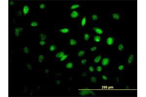 Immunofluorescence of monoclonal antibody to FOXF2 on HeLa cell. (FOXF2 antibody  (AA 346-443))