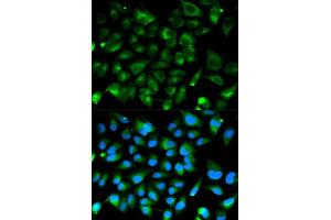 Immunofluorescence analysis of HeLa cell using PRKAR1A antibody. (PRKAR1A antibody  (AA 1-250))
