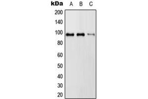 Western blot analysis of RASA3 expression in HeLa (A), SP2/0 (B), H9C2 (C) whole cell lysates. (RASA3 antibody  (Center))