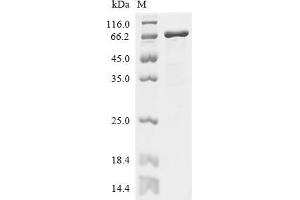 Protein S (PROS) (AA 1-572), (full length) protein (His tag)