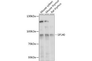 Western blot analysis of extracts of various cell lines, using SP140 antibody (ABIN7270507) at 1:1000 dilution. (SP140 antibody  (AA 1-180))