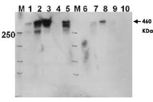 Western blot using PRKDC (phospho T2609) polyclonal antibody  shows detection of a 460 KDa band corresponding to human PRKDC in various preparations.