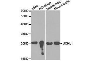 Western Blotting (WB) image for anti-Ubiquitin Carboxyl-terminal Esterase L1 (Ubiquitin Thiolesterase) (UCHL1) antibody (ABIN1875266) (UCHL1 antibody)