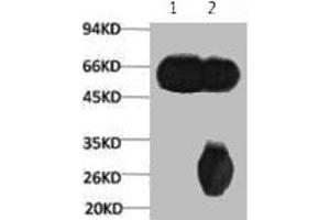 1) Input: Mouse Brain Tissue Lysate 2) IP product: IP dilute 1: 200 (TUBB3 antibody)