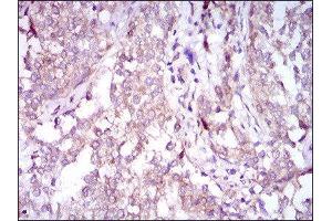Immunohistochemistry (IHC) image for anti-Sequestosome 1 (SQSTM1) (AA 232-356) antibody (ABIN1846090) (SQSTM1 antibody  (AA 232-356))