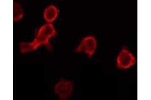 ABIN6275015 staining RAW264. (CKLF antibody)